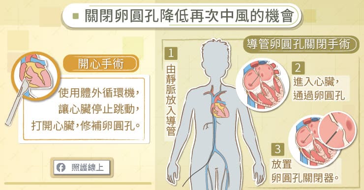 靜脈