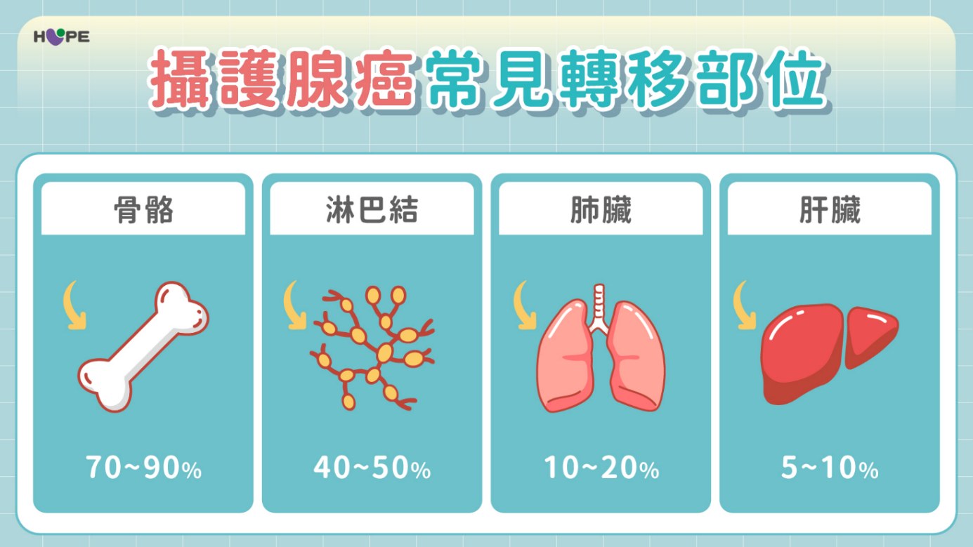 晚期攝護腺癌治療選擇更多！BRCA 1/2基因檢測助力精準治療