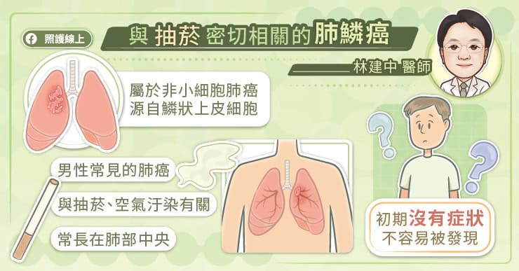 與抽菸密切相關的肺鱗癌