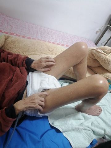 試用者實拍