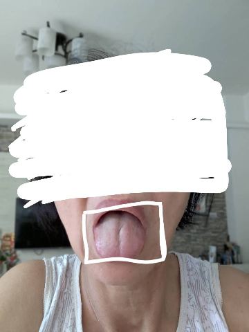 試用者實拍