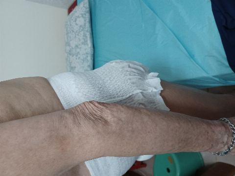 試用者實拍