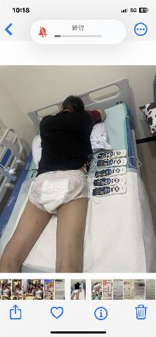 試用者實拍