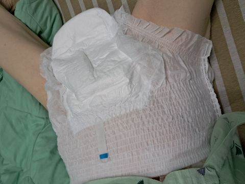 試用者實拍