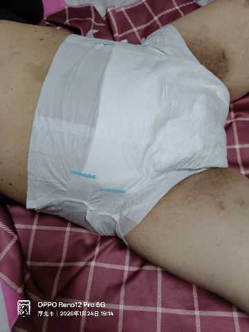 試用者實拍