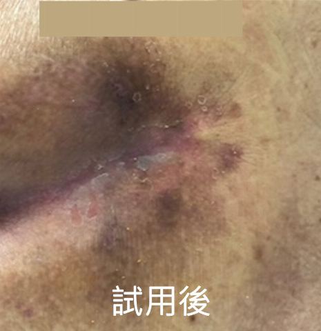 試用者實拍